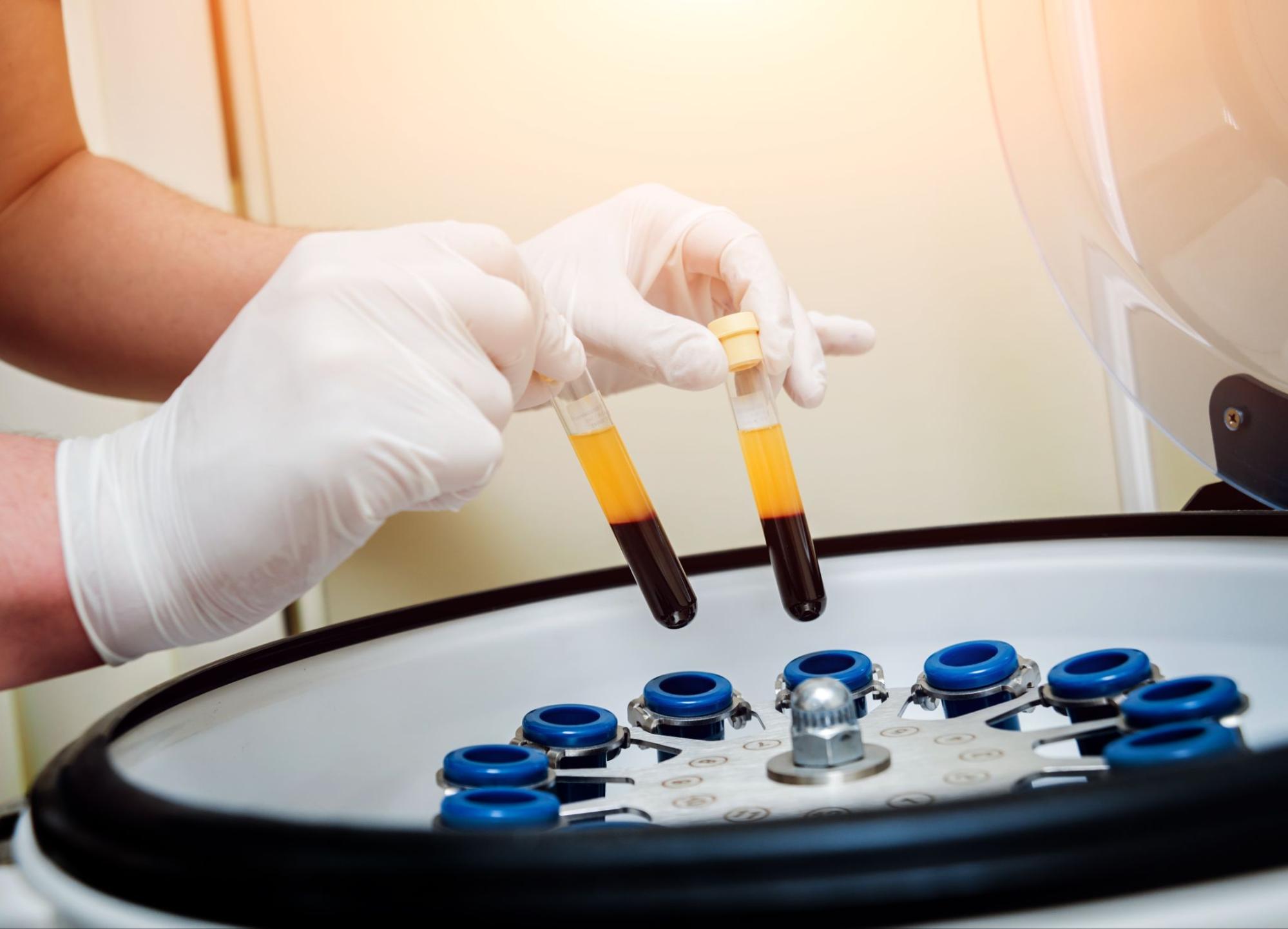 What Is Regenerative Medicine and How Can It Help Your Pain?